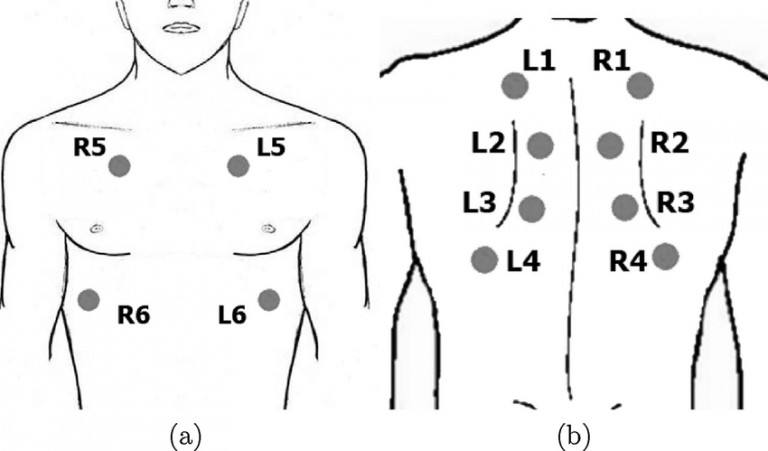 Lung Landmarks For Auscultation